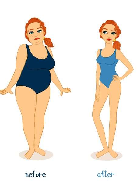 HYPNOTIC GASTRIC BAND