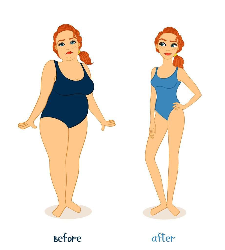 HYPNOTIC GASTRIC BAND
